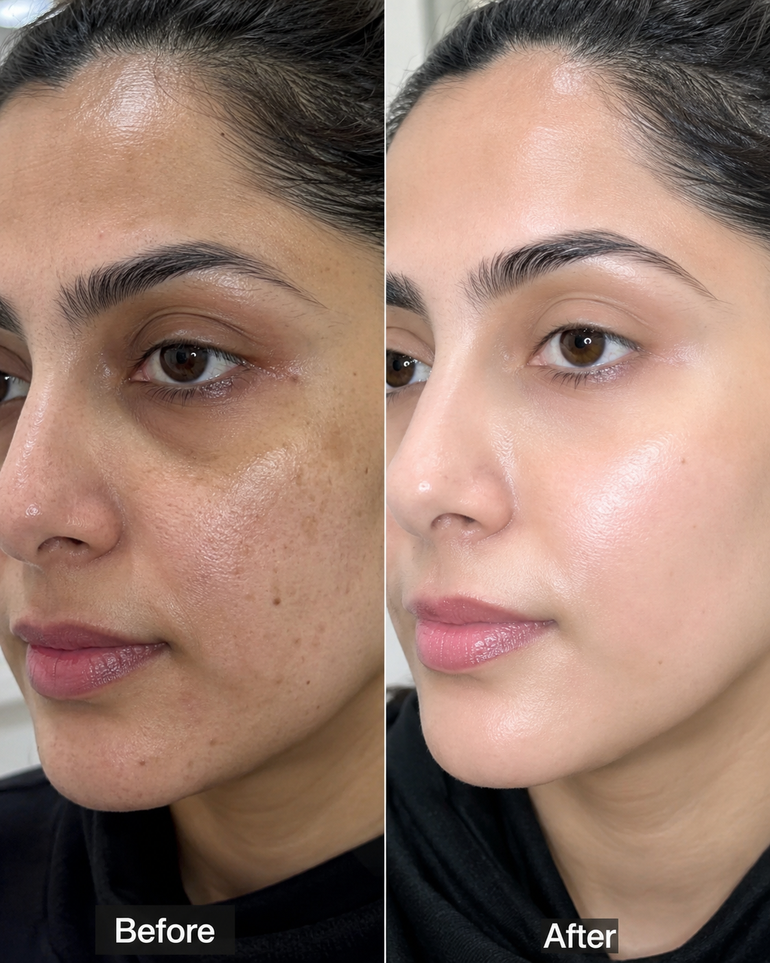 Skin Transformation